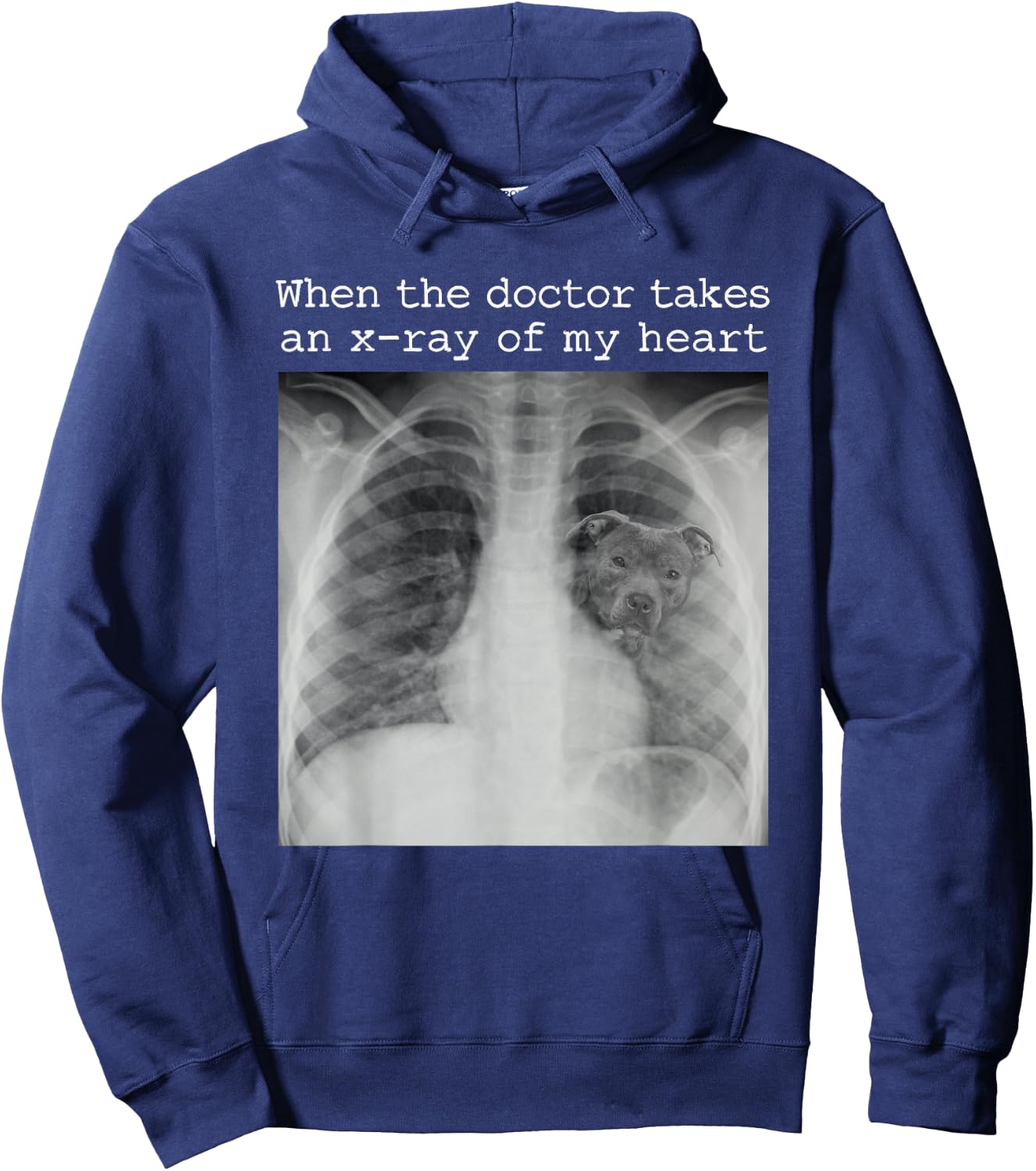 When The Doctor Takes an X-ray of My Heart Pit Bull Mom Hoodie - Hoodie | Navy