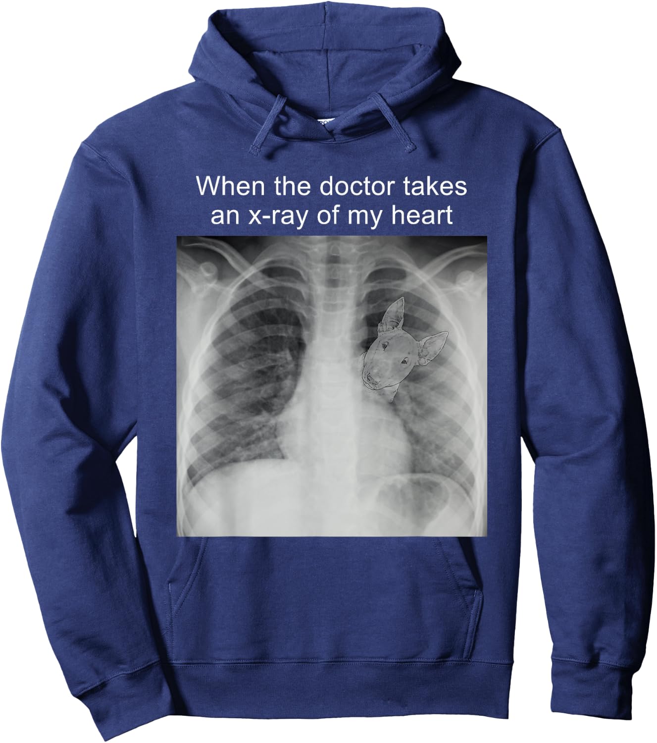 When The Doctor Takes an X-ray of My Heart Bull Terrier Mom Hoodie - Hoodie | Navy