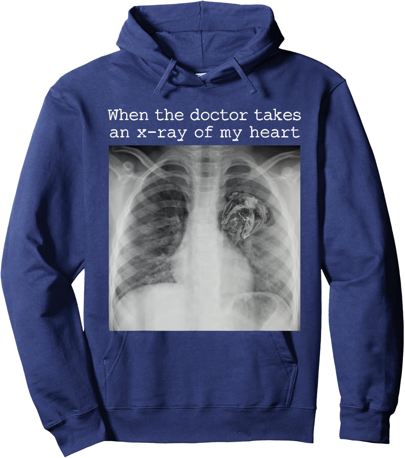 When The Doctor Takes an X-ray of My Heart Bulldog Mom Hoodie - Hoodie | Navy
