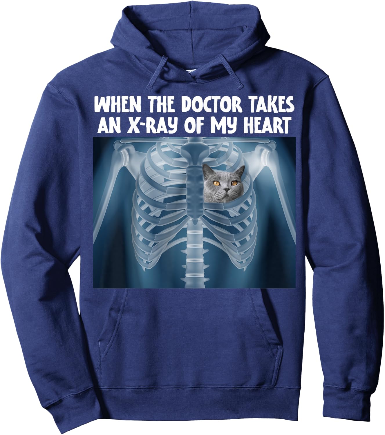 When Doctor Takes X-ray Of My Heart Funny Russian Blue Cat Hoodie - Hoodie | Navy