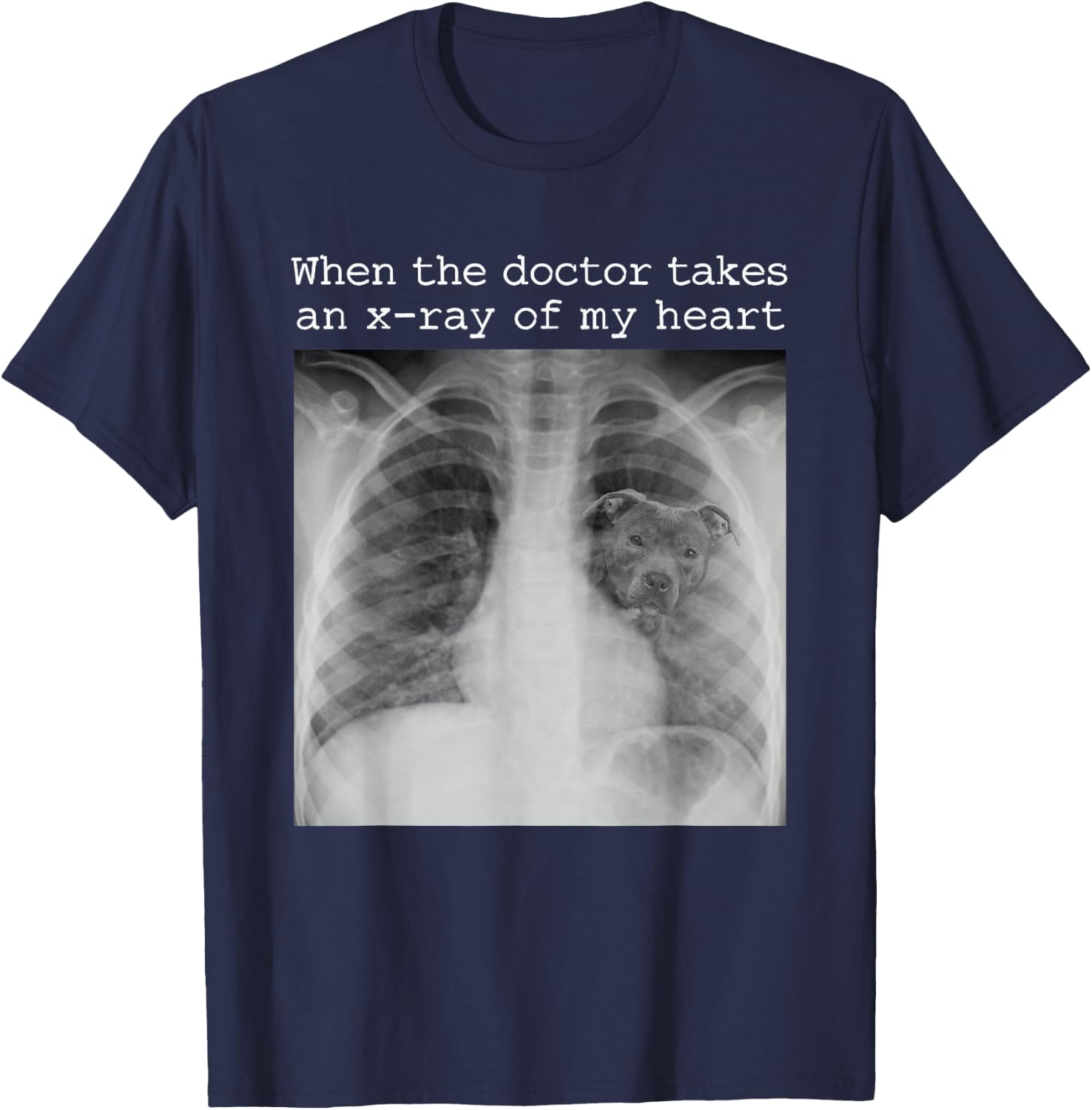 When The Doctor Takes an X-ray of My Heart Pit Bull Mom T-Shirt - T-Shirt | Navy