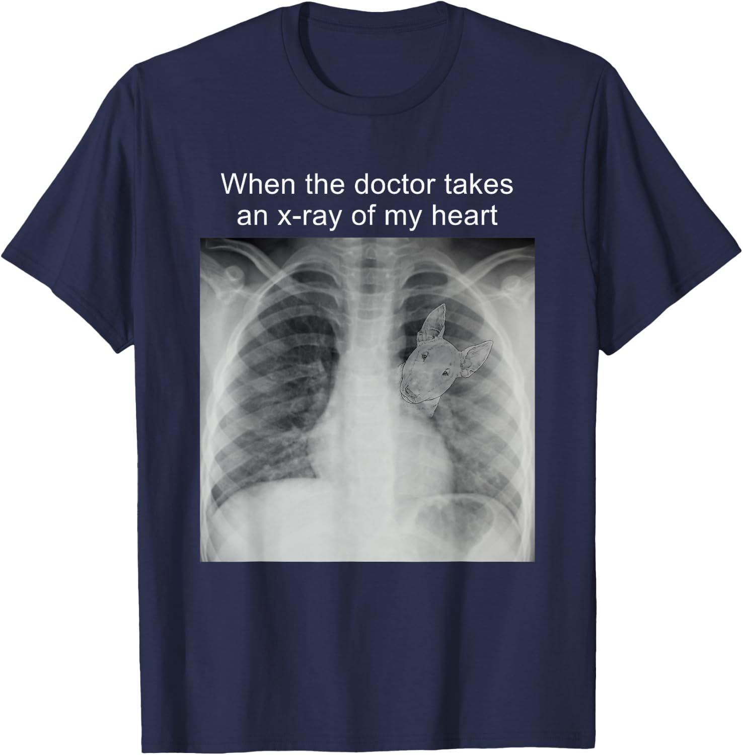 When The Doctor Takes an X-ray of My Heart Bull Terrier Mom T-Shirt - T-Shirt | Navy