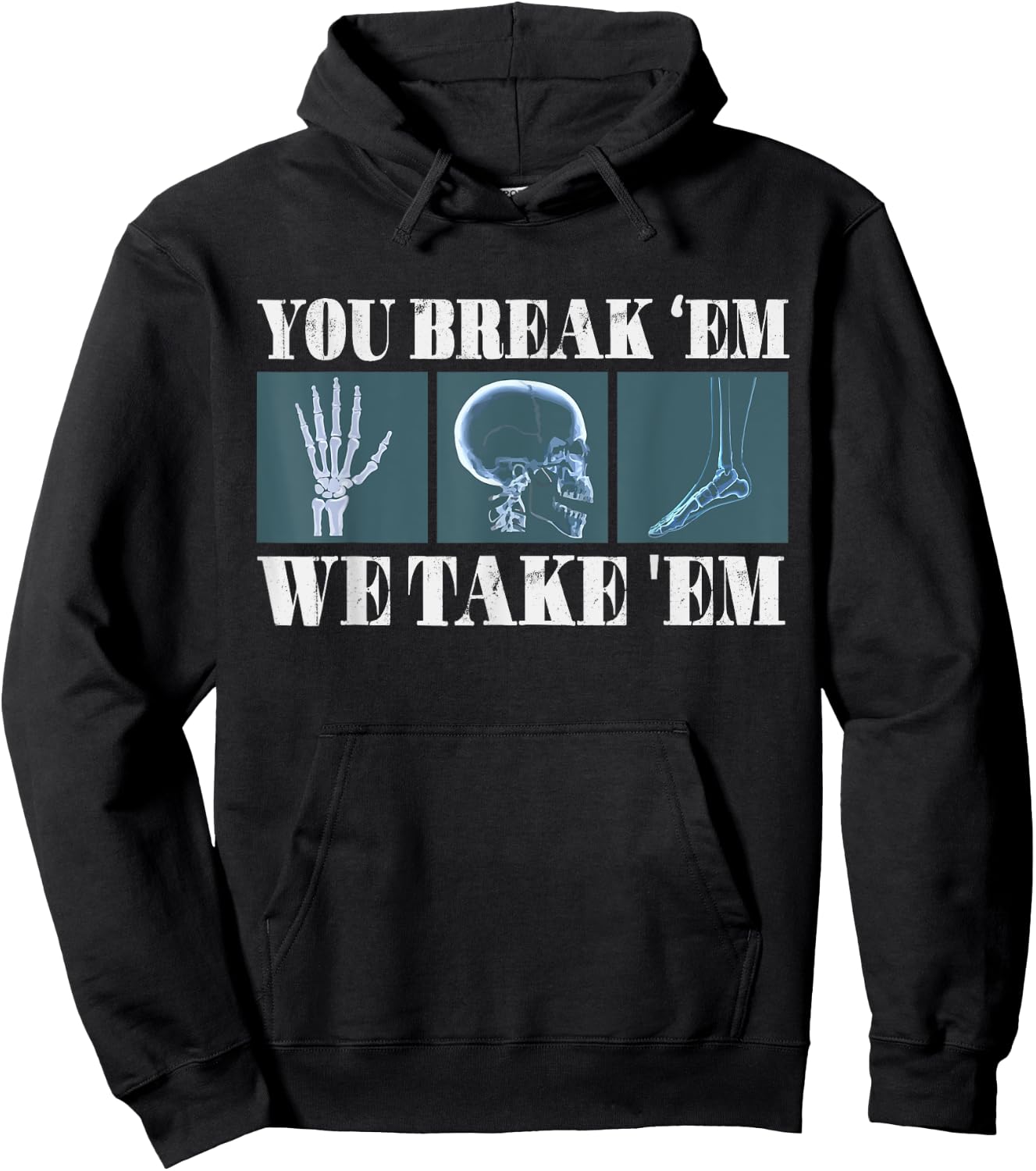 Radiology Joke Radiologists Rad Tech Xray X-Ray Radiologist Hoodie - Hoodie | Black