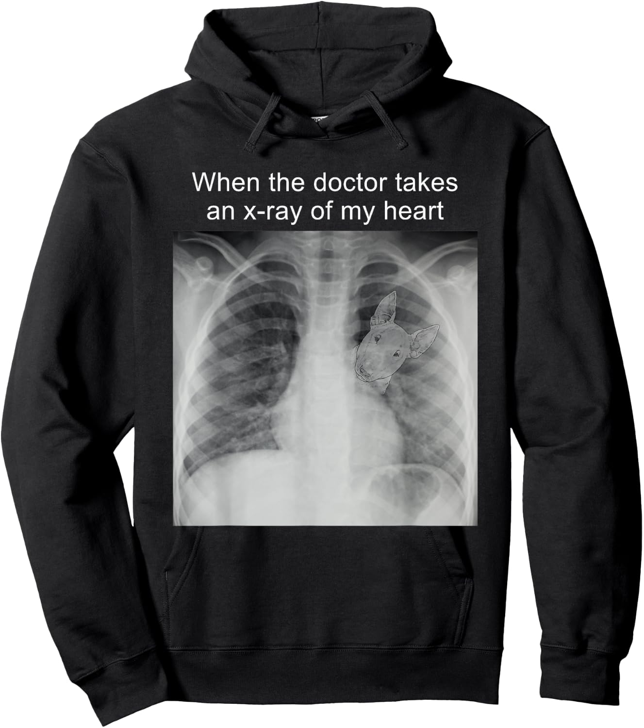 When The Doctor Takes an X-ray of My Heart Bull Terrier Mom Hoodie - Hoodie | Black