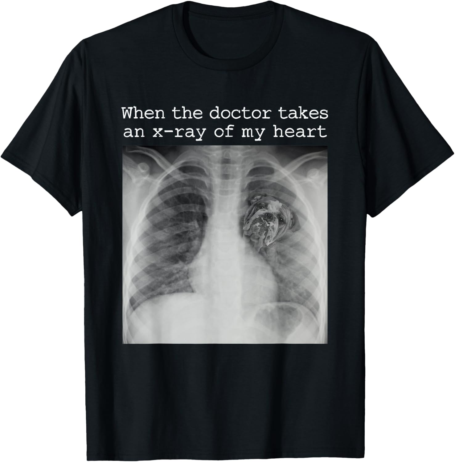 When The Doctor Takes an X-ray of My Heart Bulldog Mom T-Shirt - T-Shirt | Black